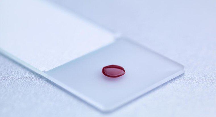 Cos'è un esame del sangue LDH?