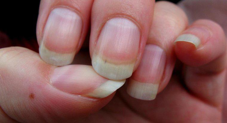 Quali sono le cause di creste nelle unghie?