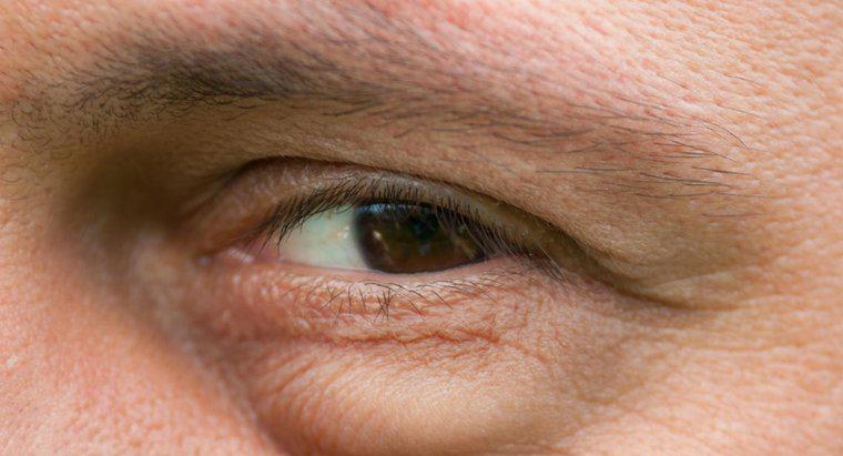 Quali sono le possibili cause di gonfiore sotto gli occhi?