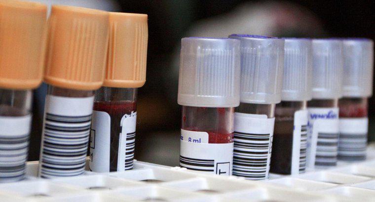 Cos'è un esame del sangue dei neutrofili?