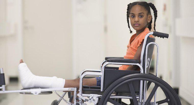 Quanto tempo ci vuole per recuperare da una gamba rotta?