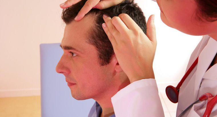 Che tipo di dottore tratta la perdita dei capelli?
