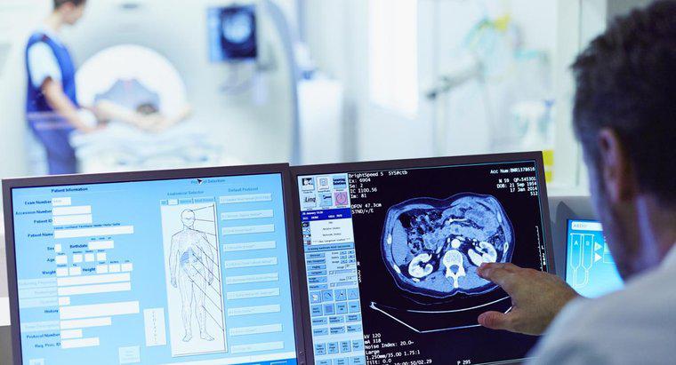 Quanto tempo ci vuole per ottenere risultati di scansione CT?