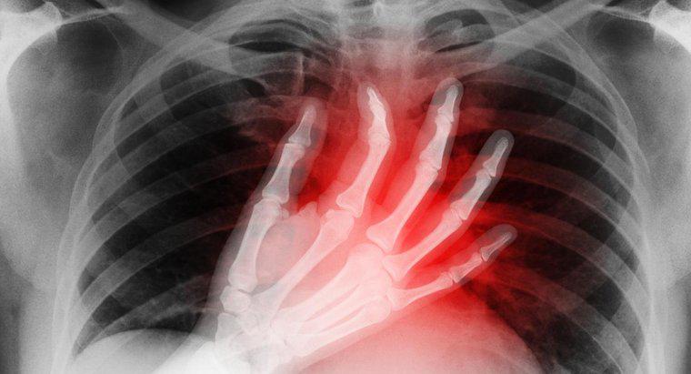 Quali sono i sintomi di un Mini Heart Attack?