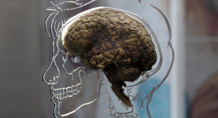 Quali sono i sintomi di una lesione cerebrale?