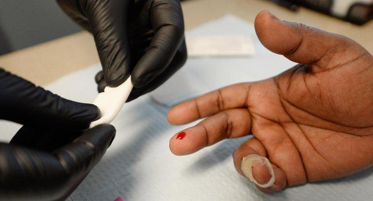 Quanto tempo impiega l'HIV a presentarsi ai test?