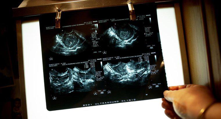 Qual è la differenza tra ultrasuoni e infrasuoni?