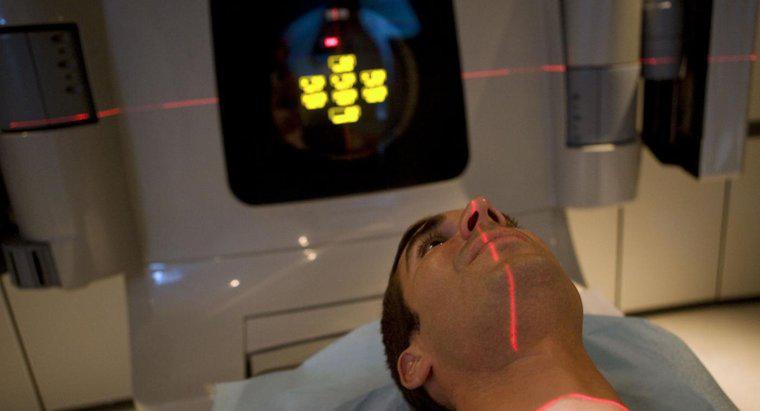 Quali sono gli effetti della radioterapia?