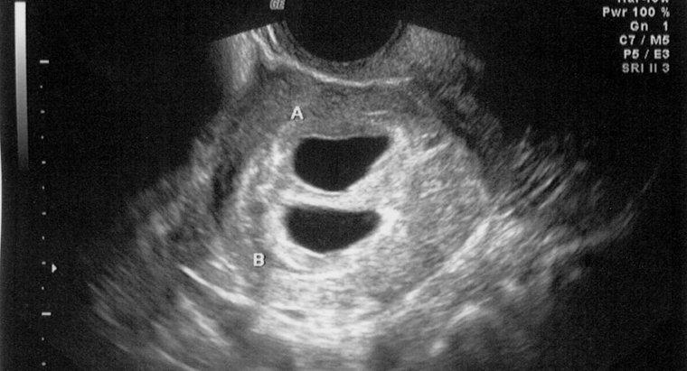 Un ultrasuono può rilevare una gravidanza a 4 settimane?