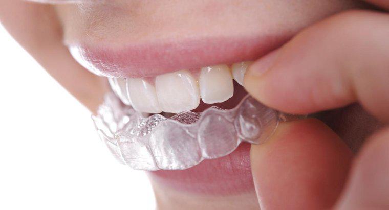 Come si raddrizzano i denti senza bretelle?