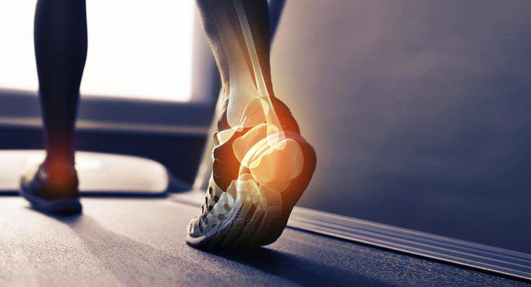 Cosa provoca uno sperone osseo sul tallone del piede?