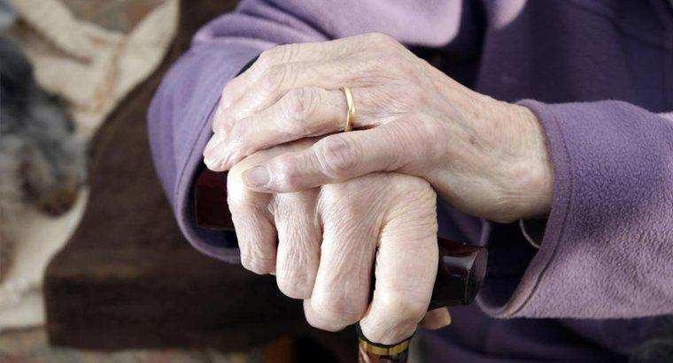 Come viene diagnosticata l'artrite nelle mani?