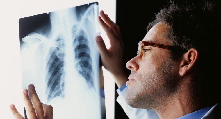 Come viene trattata un'infezione polmonare?