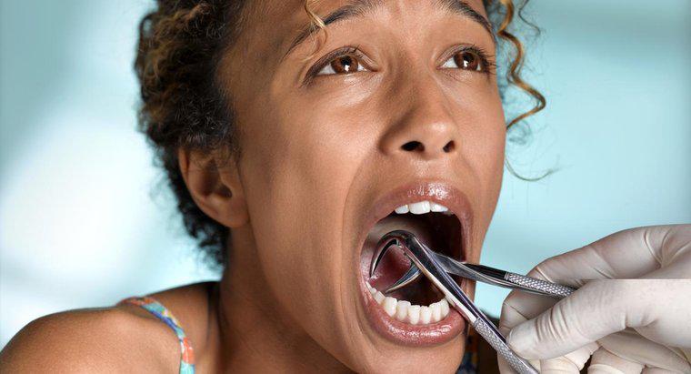 Come tratti un'infestazione dopo l'estrazione del dente?