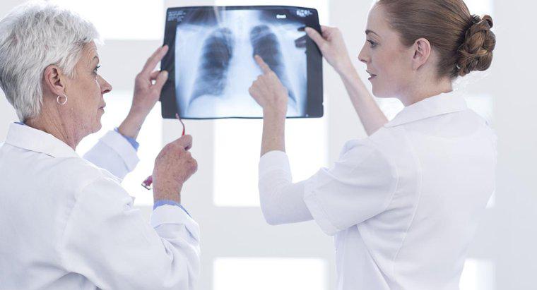 Cosa fanno i polmoni nel sistema respiratorio?