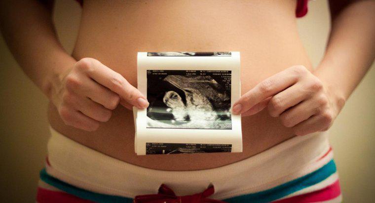 Qual è l'ordine corretto delle fasi dello sviluppo prenatale?