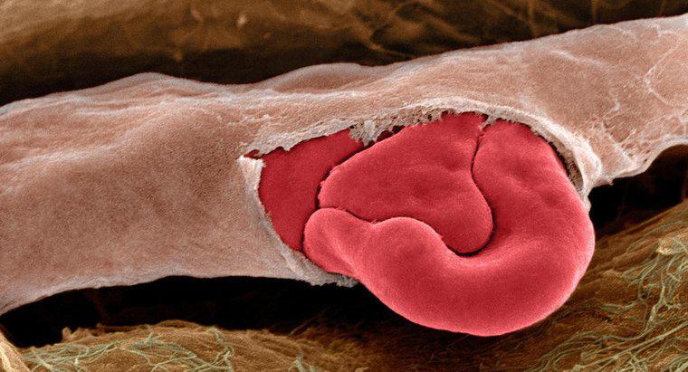 Cosa causa la rottura dei vasi sanguigni?