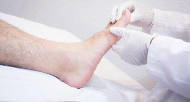 Quali sono i rischi per la salute coinvolti nei piedi gonfi?