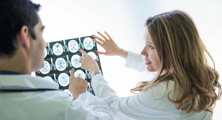 Quali sono alcuni sintomi di un tumore al cervello?