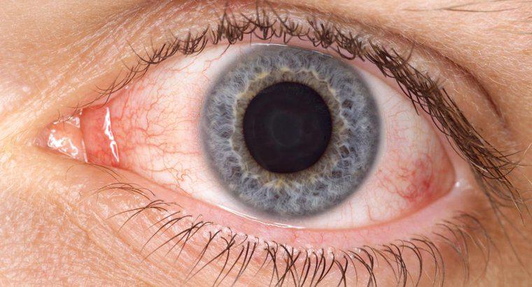 In che modo l'acido borico aiuta con l'occhio rosa?
