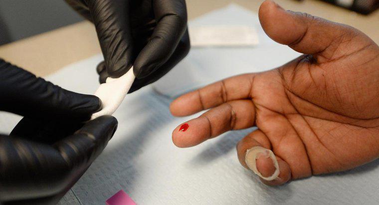 Quali sono i primi sintomi dell'HIV?