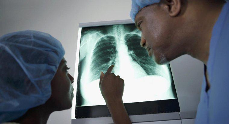 Cosa significa una messa sul polmone?