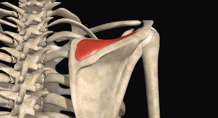 Che cosa è una piccola lacerazione del tendine distale del Supraspinatus interstiziale?