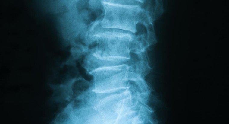 Cos'è una colonna vertebrale toracolombare?