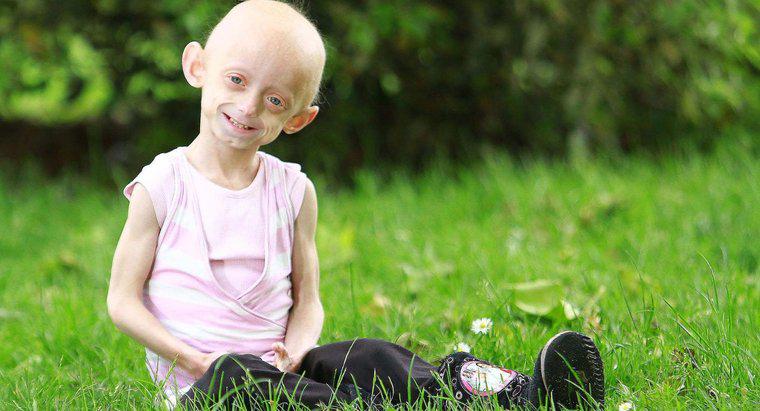 Quali sono alcuni fatti interessanti su Progeria?