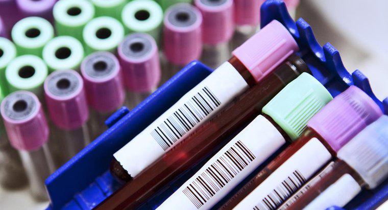 Quali sono le abbreviazioni comuni su un esame del sangue?