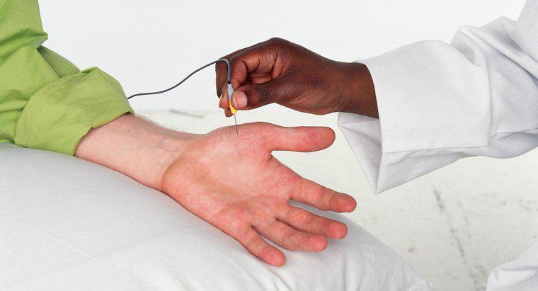 In che modo i test EMG valutano il danno ai nervi?