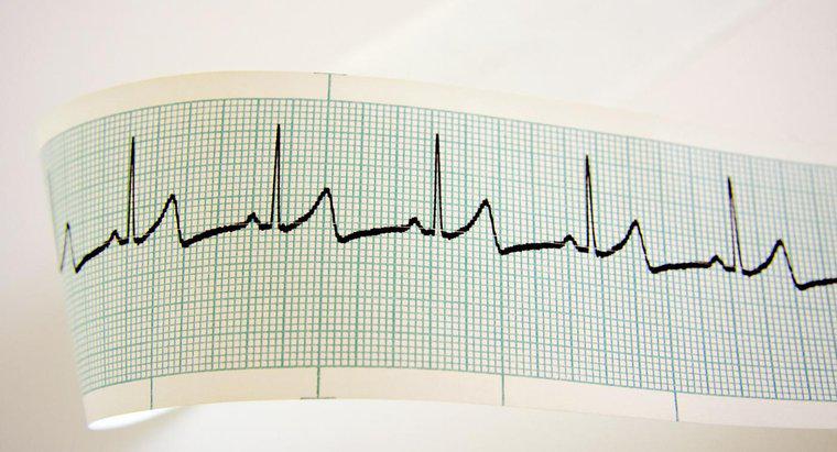 Che cosa causa un battito cardiaco rapido?