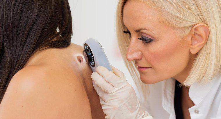 Quali siti Web medici mostrano immagini di tipi di cancro della pelle?