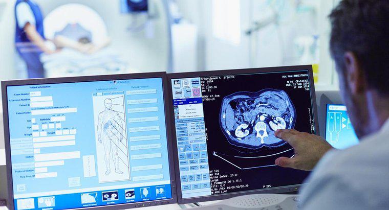 Quali sono i vantaggi e gli svantaggi delle scansioni CT?