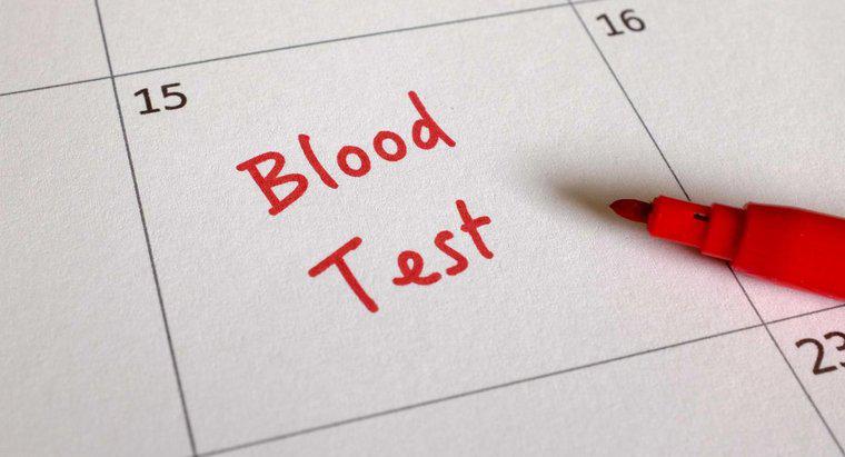 Che cos'è un esame del sangue CA 125?