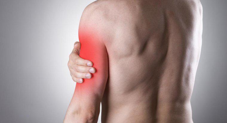 Un nervo pizzicato può causare dolore al braccio sinistro?