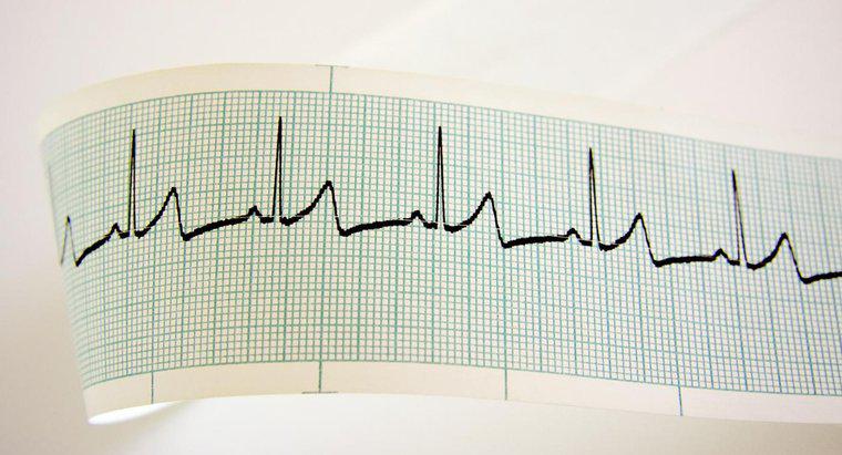 Qual è la frequenza cardiaca media per una donna?