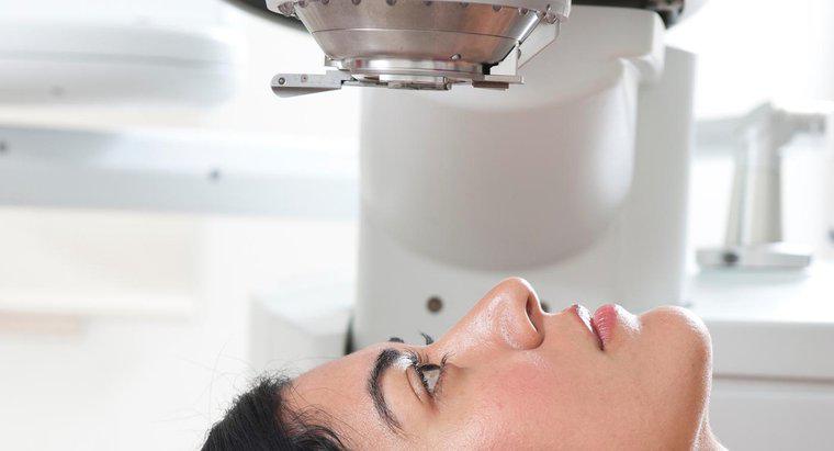 Quali sono i trattamenti laser per il glaucoma?