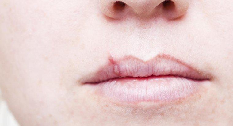 Qual è il primo segno di cancro al labbro?