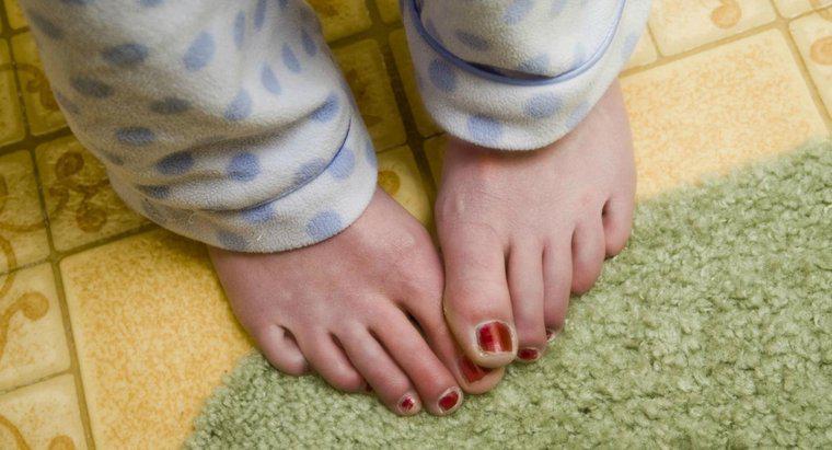 Quali sono alcuni problemi comuni di toenail?