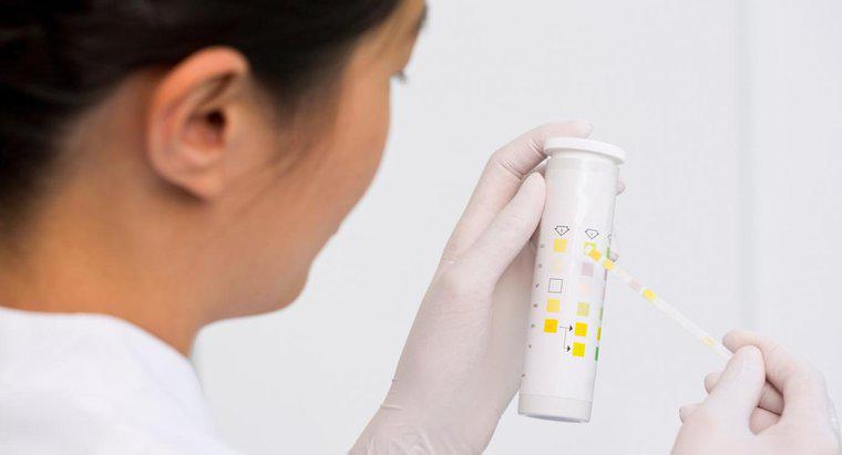 Che cosa è un test di microalbumina delle urine del diabete per?