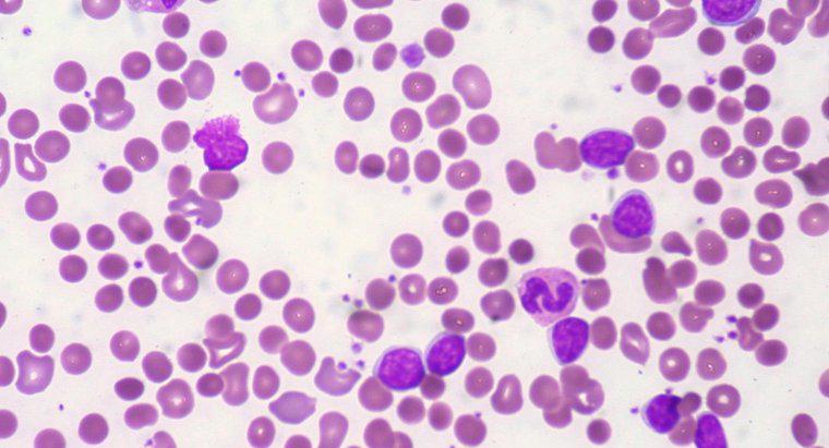 Che cos'è un conteggio dell'emoglobina normale?