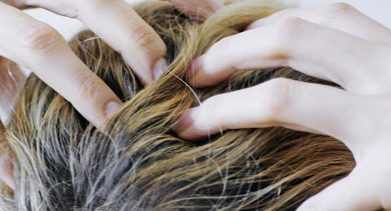 Quali sono le cause prurito del cuoio capelluto e perdita di capelli?