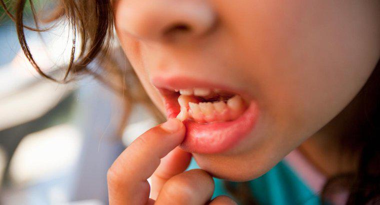 Quali sono le cause Denti allentati negli adulti?