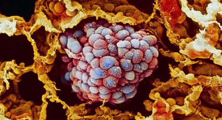 Quali sono le cellule pre-cancerose?