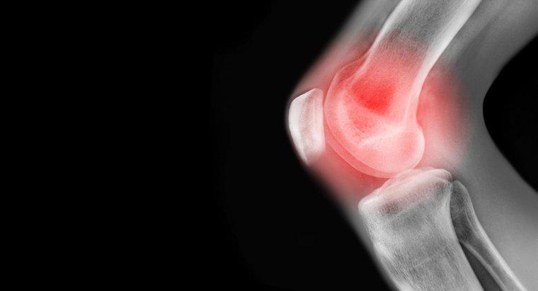 Quali sono alcune cause del dolore al ginocchio sinistro?