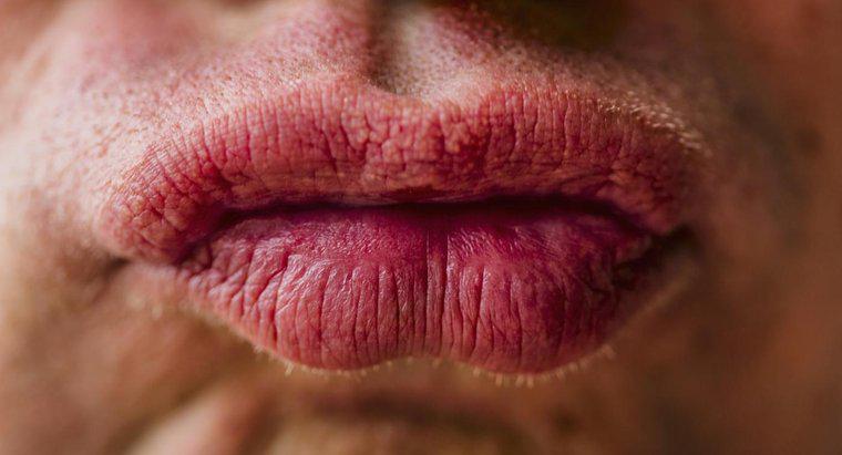 Come si trattano le labbra gonfie a causa di un'allergia?