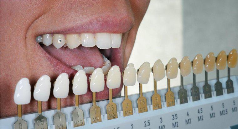I denti falsi possono essere sbiancati?