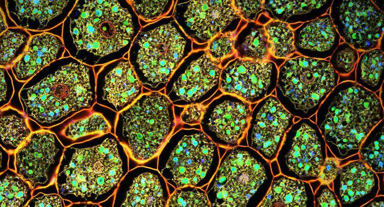 Qual è la differenza tra le cellule vegetali vs. Cellule animali?
