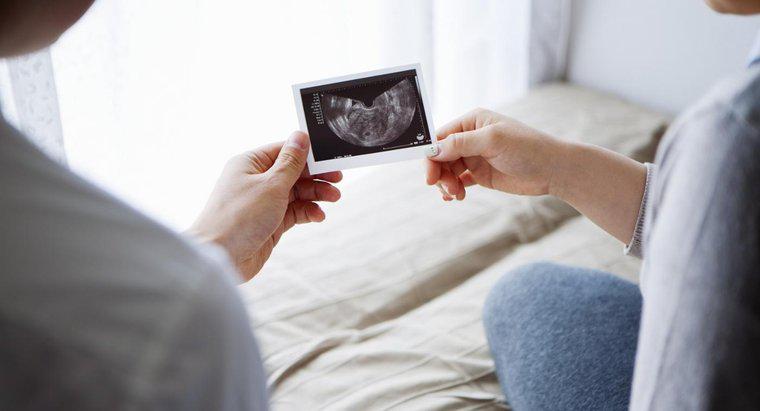 Come puoi determinare se un feto è maschio o femmina?